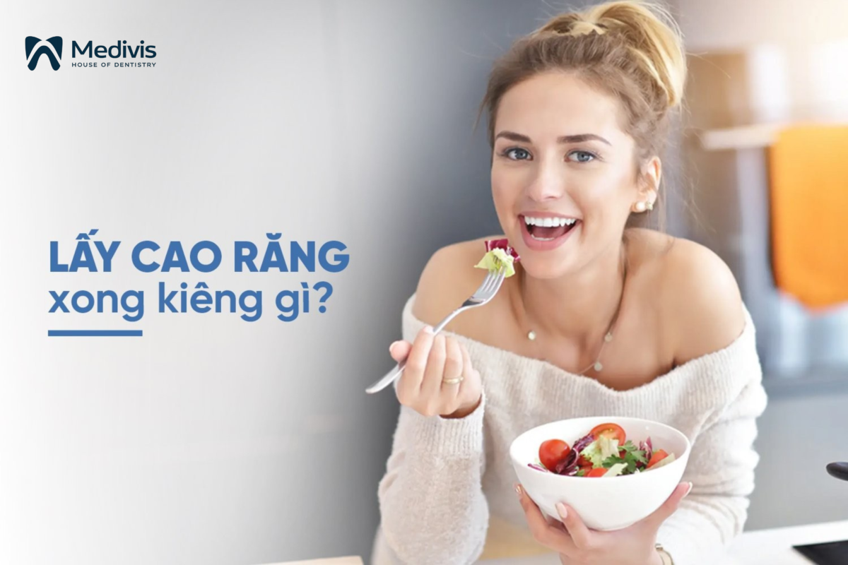 Lấy cao răng xong kiêng gì