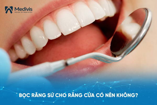 Bọc răng sứ cho răng cửa có nên không, có hiệu quả không? 2