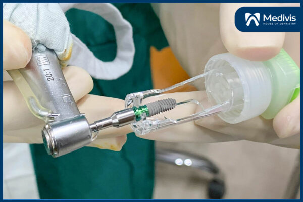 Trồng răng Implant bị sưng có sao không? - 5 cách giảm sưng hiệu quả 9