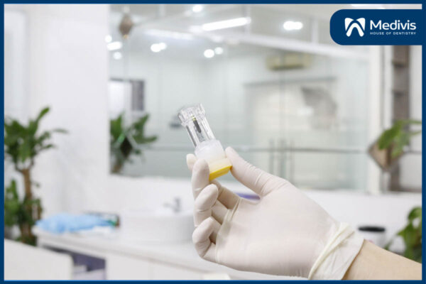 địa chỉ trồng răng uy tín ở Hà Nội 5