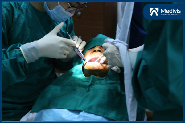 CẤY GHÉP implant all on 4 6