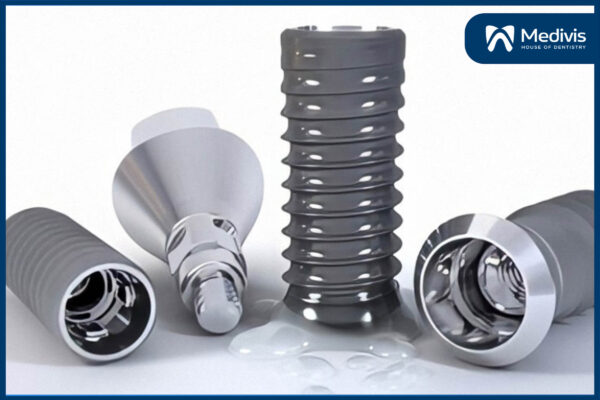 kinh nghiệm trồng răng implant 6