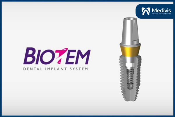 Giá trồng răng Implant Hàn Quốc 4