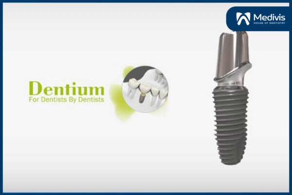 Giá trồng răng Implant Hàn Quốc 5