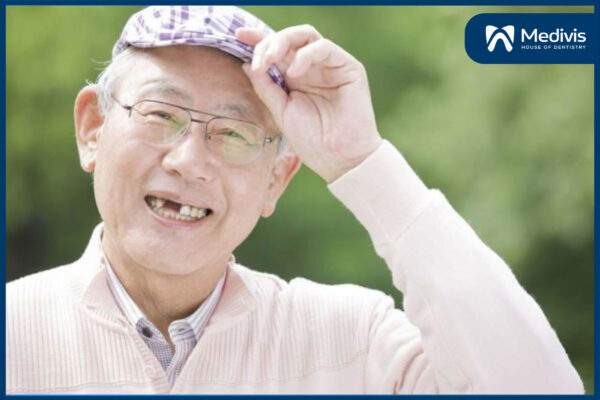 Trồng răng Implant bị sưng có sao không? - 5 cách giảm sưng hiệu quả 1