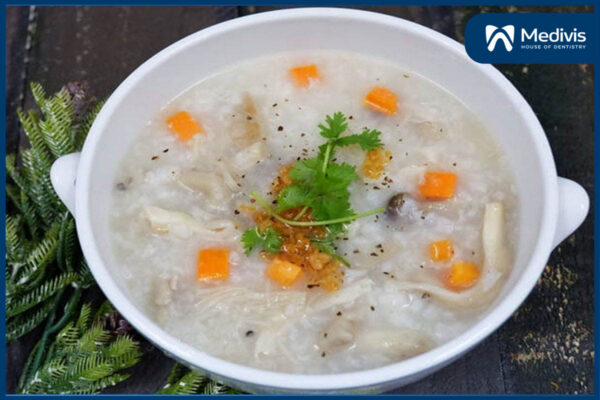 Niềng răng 7