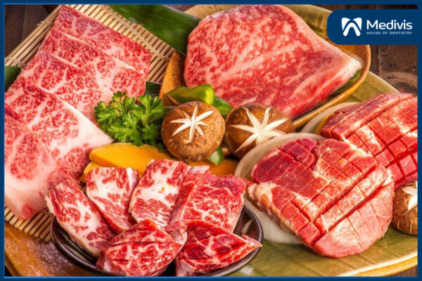 Sau khi niềng răng nên ăn gì? - Tổng hợp món ăn tốt cho người niềng răng 6