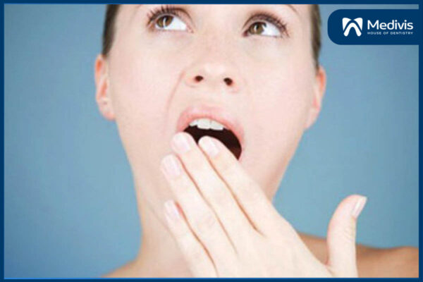 Răng khôn mọc ngầm là gì? Cách giải quyết răng mọc ngầm TRIỆT ĐỂ! 4