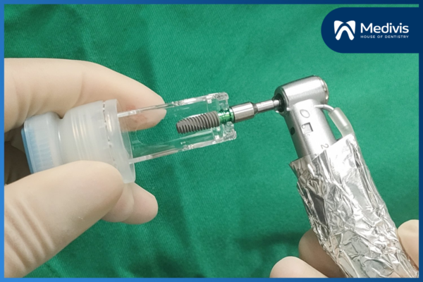 Trồng răng implant Hàn Quốc - Chi phí THẤP, chất lượng CAO! 2