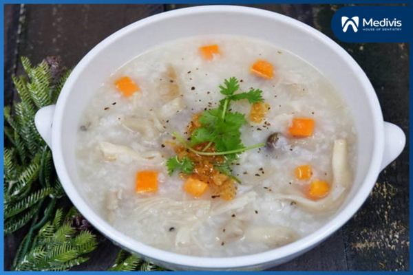 Niềng răng cửa - Giải pháp TỐI ƯU cho hàm răng đều đẹp & hài hòa 2