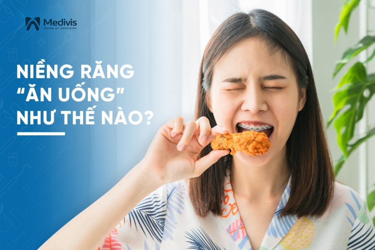 Người niềng răng ăn uống như thế nào? Nên và không nên ăn gì? 1